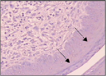 Image for - The Establishment and Use of an in vivo Animal Model for Cervical Intra-Epithelial Neoplasia