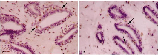 Image for - Protective Effect of Green Alage Against 7,12-Dimethylbenzanthracene (DMBA)-Induced Breast Cancer in Rats