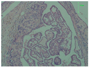 Image for - Dietary Fiber and DMBA-induced Rat Mammary Carcinomas