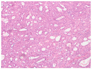 Image for - Dietary Fiber and DMBA-induced Rat Mammary Carcinomas