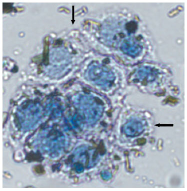 Image for - Synergistic Effects of Green Tea Catechin and Phytic Acid Increases the Cytotoxic Effects on Human Colonic Adenocarcinoma Cell Lines