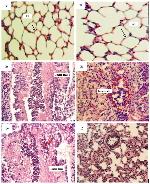 Image for - Anti-Angiogenic Effectiveness of the Pomegranate Against Benzo(a)Pyrene Induced Lung Carcinoma in Mice