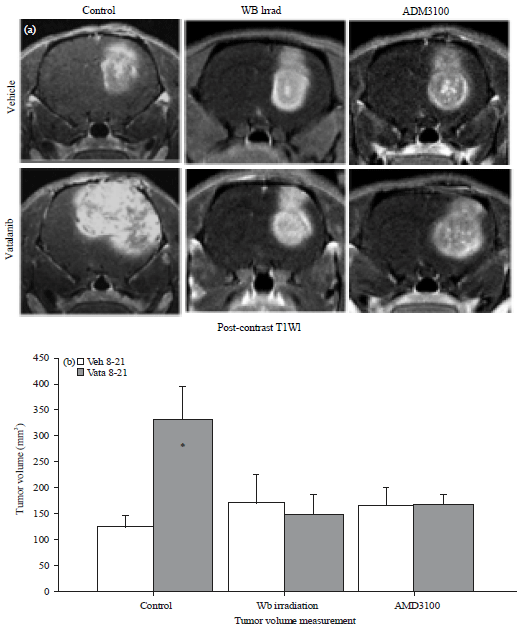 Image for - Targeting Bone Marrow to Potentiate the Anti-Tumor Effect of Tyrosine Kinase Inhibitor in Preclinical Rat Model of Human Glioblastoma