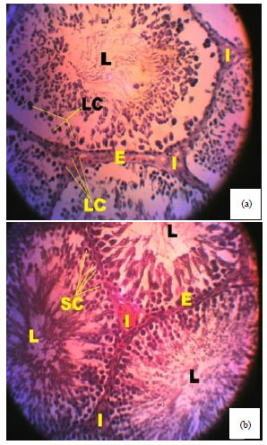 Image for - Spermiographic, 2 and 3-dimensional Quantitative Analysis ofTesticular Tissues of Rat Submitted to Citrus paradisi WasteExtract and Cisplatin-induced Cytotoxicity