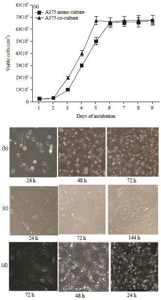 Image for - Expression of Collagenases Matrix Metalloproteinases and YB-1 Oncogenic Factor in Malignant Melanoma Cancer Cells and its Regulation by Stromal Fibroblasts
