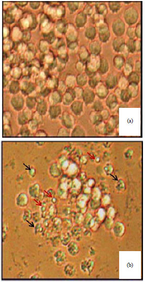 Image for - Antiproliferative and Apoptotic Effect of Newcastle Disease Virus(NDV) Strain AF2240 in Human Promyelocytic Leukemia Cells(HL60)