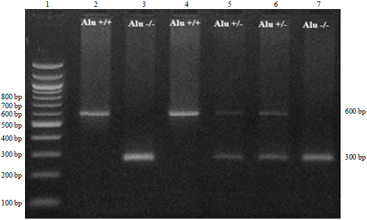 Image for - Deletion of the Alu Repeat in the Tissue Plasminogen Activator (tPA) Gene For Protection of Breast Cancer