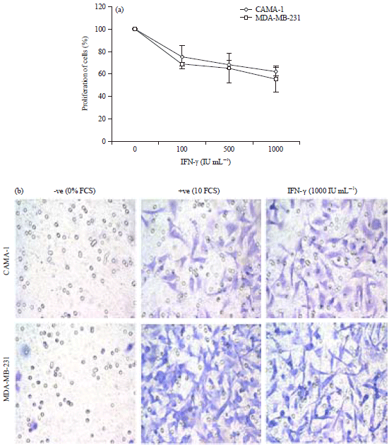 Image for - CD74 a Potential Therapeutic Target for Breast Cancer Therapy: Interferon Gamma Up-regulates its Expression in CAMA-1 and MDA-MB-231 Cancer Cells