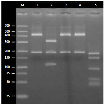 Image for - Evaluation of Genetic Diversity in Vigna radiata (L.) Using Protein Profiling and Molecular Marker (RFLP)