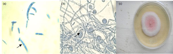 Image for - Occurrence of Arbuscular Mycorrhizal Fungi and Fusarium in TC Banana Rhizosphere Inoculated with Microbiological Products in Different Soils in Kenya