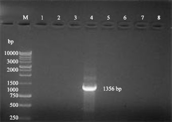 Image for - Isolation and Antigenic and Molecular Characterization of G10 of Group A Rotavirus in Camel