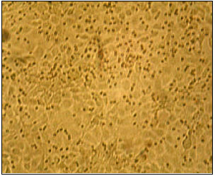 Image for - Isolation and Characterization of PI-3 Virus from Sheep and Goats