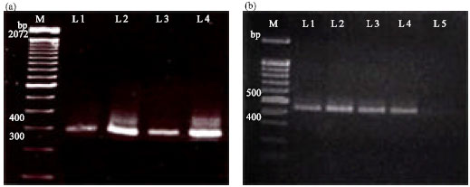 Image for - Biological, Serological and Molecular Diagnosis of  Three Major Potato Viruses in Egypt