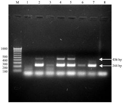 Image for - First Year of the Highly Pathogenic Avian Influenza H5N1 Outbreak in Egypt: Rapid Antigenic/Molecular Diagnosis and Virus Isolation