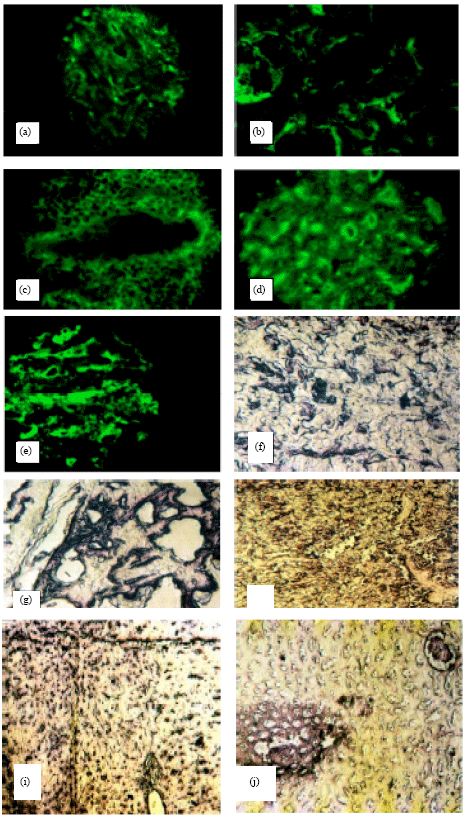 Image for - Lumpy Skin Disease Virus Identification in Different Tissues of Naturally Infected Cattle and Chorioallantoic Membrane of Emberyonated Chicken Eggs Using Immunofluorescence, Immunoperoxidase Techniques and Polymerase Chain Reaction