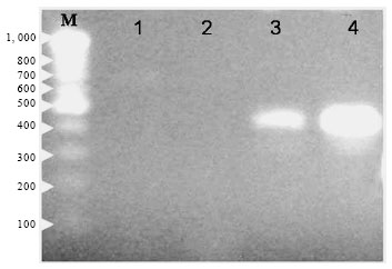 Image for - Establishment of Dot-blot Hybridization for Diagnosis of Bovine Ephemeral Fever Virus in Egypt