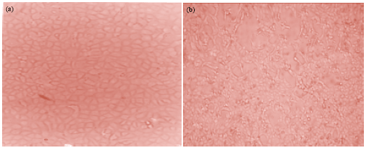 Image for - Effect of Acyclovir on Bovine Herpesvirus Type 1 Infection in in vitro Cultured Cells