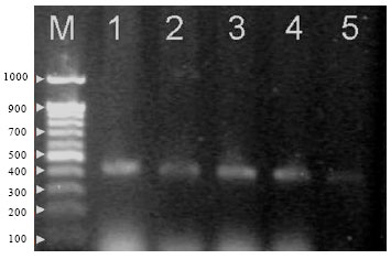 Image for - Establishment of Dot-blot Hybridization for Diagnosis of Bovine Ephemeral Fever Virus in Egypt