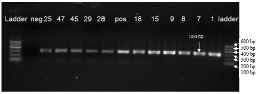 Image for - Comparative Detection of H5N1 Avian Influenza Virus Using Conventional Rt-PCR and Real Time Rt-PCR