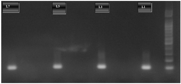 Image for - Detection of Human Metapneumo Virus among Infants with Bronchiolitis