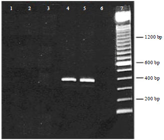 Image for - Rapid Detection of Foot and Mouth Disease Virus from Tongue Epithelium of Cattle and Buffaloes in Suez Canal Area, Egypt from 2009-2011