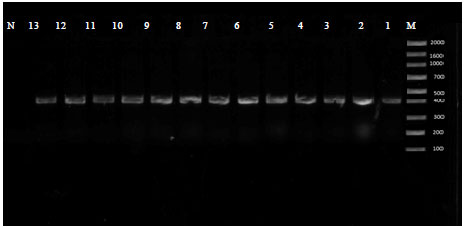 Image for - Detection and Molecular Characterization of Infectious Bronchitis virus  Isolated from Recent Outbreaks in Chicken Farms in Egypt 2012