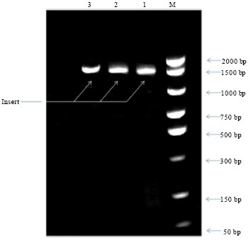 Image for - Production of Recombinant Rift Valley Fever Virus Glycoprotein 1 by Bacterial System