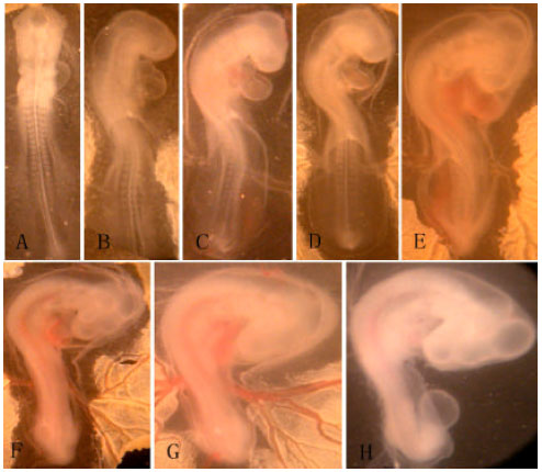 Image for - Studies on the Relationship between the Embryonic Heart Development and the Amnion Folding in Chick