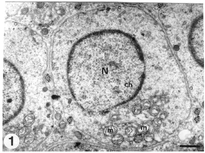 Image for - Ultrastructure of Sperm Head Differentiation in the Lizard, Acanthodactylus boskinus (Squamata, Reptilia)