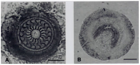 Image for - First Record of Trichodina compacta Van As and Basson, 1989 (Protozoa: Ciliophora) from Cultured Nile Tilapia in theState of Santa Catarina, Brazil