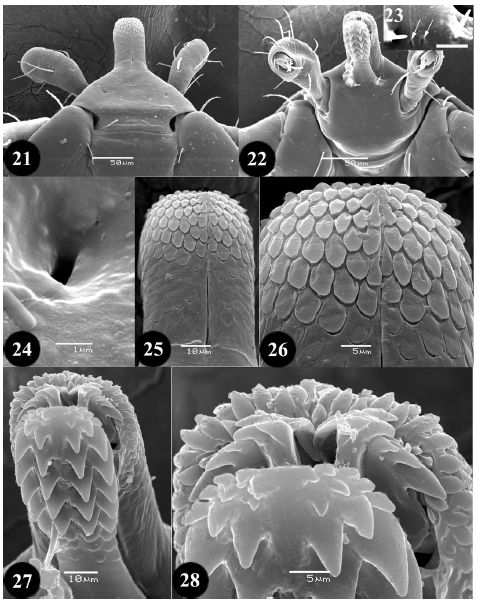 Image for - The Camel Tick, Hyalomma (Hyalomma) dromedarii Koch, 1844 (Ixodoidea: Ixodidae): Description of the Egg and Redescription of the Larva by Scanning Electron Microscopy