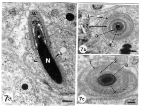 Image for - Ultrastructure of Sperm Head Differentiation in the Lizard, Acanthodactylus boskinus (Squamata, Reptilia)