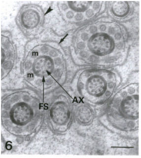 Image for - Fine Structure of the Epididymal Sperm of the Snake Eryx jayakari (Squamata, Reptilia)