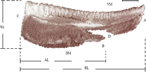 Image for - Morphologic and Morphometric Analysis and Growth Rings Identification of Otoliths: Sagitta, Asteriscus and Lapillus of Yellowfin Tuna Thunnus albacares (Bonaterre, 1788) (Pisces: Scombridae) in the Eastern Pacific