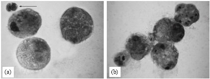 Image for - Effect of Dillenia pentagyna Extract on Sialic Acid Content and Agglutinability of Normal and Tumor Cells with Concanavalin A and Wheat Germ Agglutinin