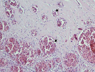 Image for - Fatal Aspergillosis in an Ostrich (Struthio camelus) Predisposed by Pulmonary Haemangioma in the Kingdom of Saudi Arabia
