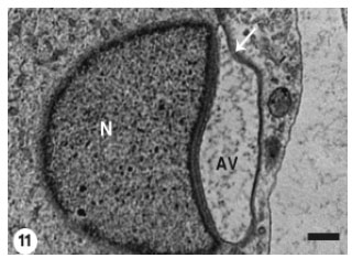 Image for - Morphogenesis of the Acrosomal Vesicle During Spermiogenesis in the House Gecko  Ptyodactylus hasselquisti (Squamata, Reptilia)
