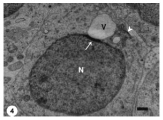 Image for - Morphogenesis of the Acrosomal Vesicle During Spermiogenesis in the House Gecko  Ptyodactylus hasselquisti (Squamata, Reptilia)