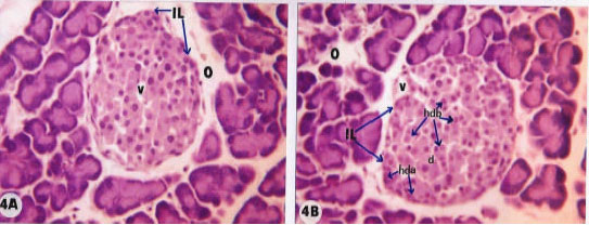 Image for - Anti-hyperglycemic, Immunomodulatory and Anti-oxidant Efficacy of Vasoactive Intestinal Peptide in Streptozotocin-Induced Diabetic Mice