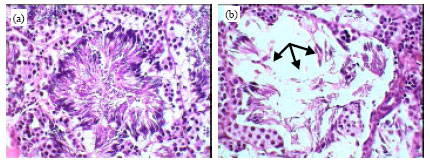 Image for - Hematological, Biochemical and Histopathological Studies on Marsh Frog, Rana ridibunda, Naturally Infected with Waltonella duboisi