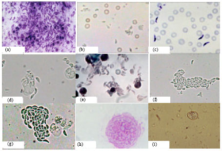 Image for - Biological Assay of Toxoplasma gondii Egyptian Mutton Isolates