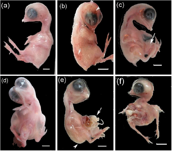 Image for - Endosulfan Impacts on the Developing Chick Embryos: Morphological, Morphometric and Skeletal Changes