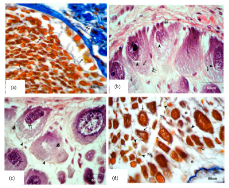Image for - Neuropathological Effect of Tributyltin on the Cerebral Ganglia of the Land Snail, Eobania vermiculata
