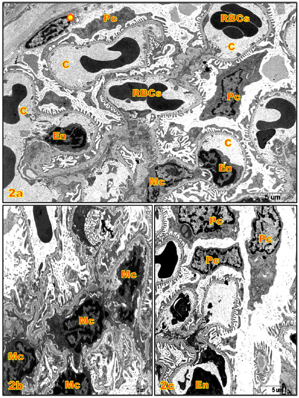 Image for - Histopathological and Ultrastructural Changes in Renal Corpuscle of Female Rats Topical Application by P-phenylene Diamine