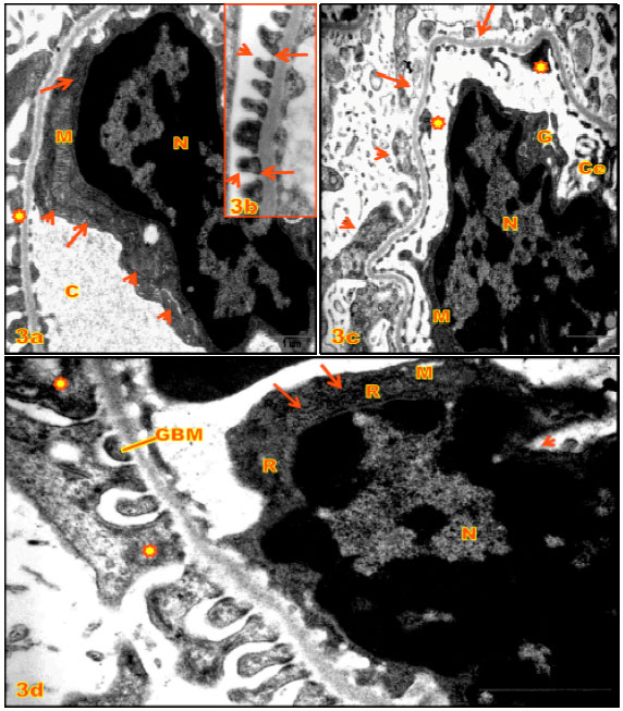 Image for - Histopathological and Ultrastructural Changes in Renal Corpuscle of Female Rats Topical Application by P-phenylene Diamine