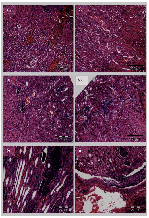 Image for - Histopathological Characteristics of Experimental Candida tropicalis Induced Acute Systemic Candidiasis in BALB/c Mice