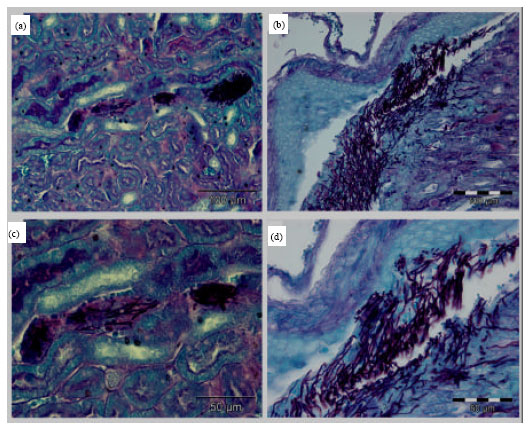 Image for - Histopathological Characteristics of Experimental Candida tropicalis Induced Acute Systemic Candidiasis in BALB/c Mice