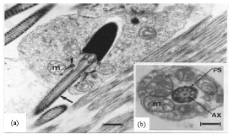 Image for - An Electron Microscope Study of Sperm Tail Differentiation of the Lizard, Acanthodactylus boskinus (Squamata: Reptilia)