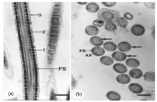Image for - An Electron Microscope Study of Sperm Tail Differentiation of the Lizard, Acanthodactylus boskinus (Squamata: Reptilia)