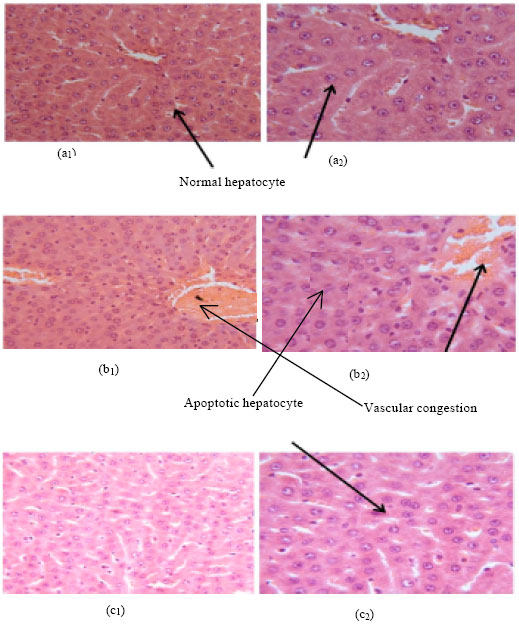 Image for - Liver Ameliorative Effects of the Hydroalcohol Extract of Rosa canina  L. Fruit against Ischemic Acute Renal Failure-induced Hepatic Damage in Wistar  Rats